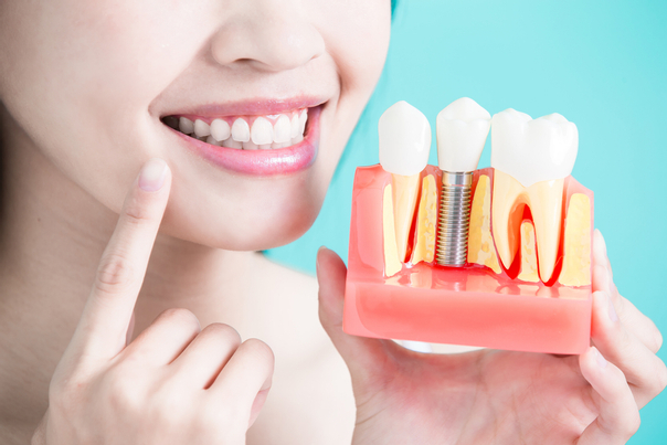 ventajas de la ortodoncia.