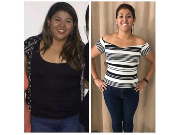 Antes y después de tratamientos para perder peso