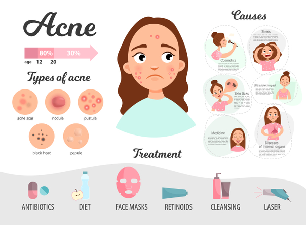 Recomendaciones para evitar acné