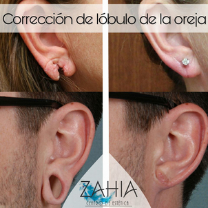 Antes y después de la cirugía reconstructiva