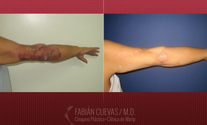 Antes y después de la cirugía reconstructiva