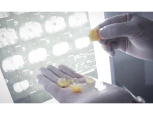 Eliminación biopolímeros del cuerpo