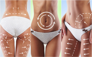 Tipos de liposucción