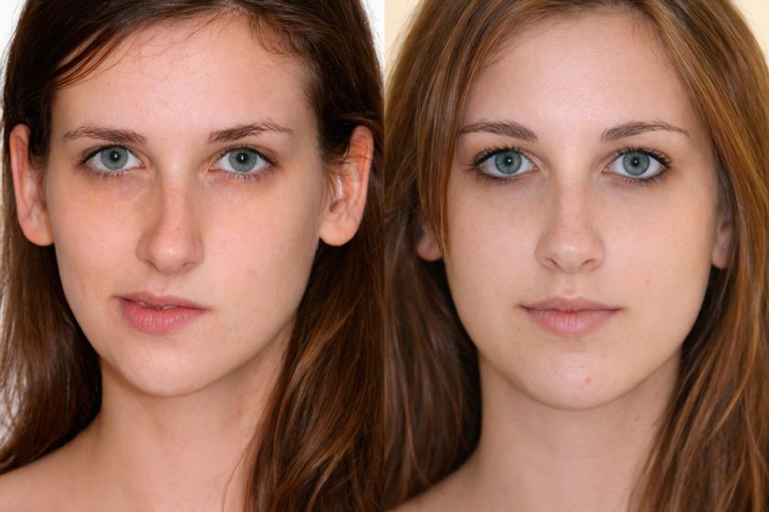 Cirugía maxilofacial