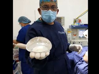 Mamoplastia de aumento - Dr. Victor Hugo Quevedo
