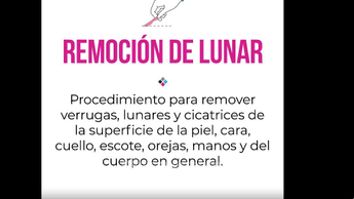 Remoción de Lunar