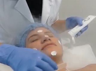 Limpieza facial profunda - Novastética