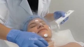 Limpieza facial profunda - Novastética