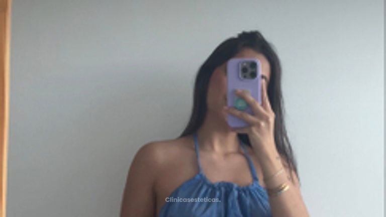 Drenaje Linfatico - Dra. Yulieth Figueroa Peñaranda