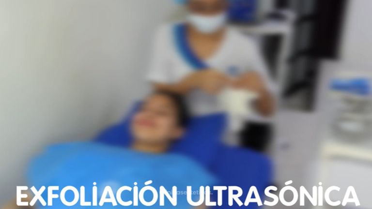 Exfoliación ultrasónica