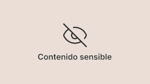 antes y después de implante capilar