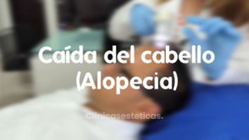 Alopecia