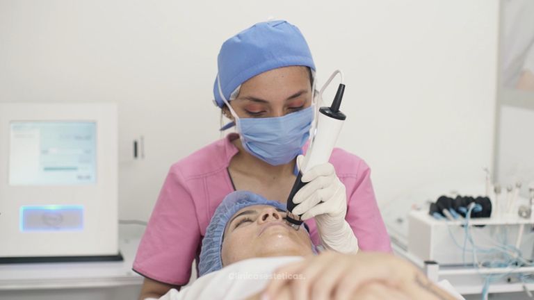 Rejuvenecimiento facial