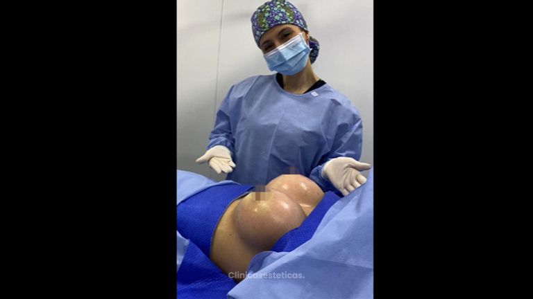 Mamoplastia de aumento - Dr. Luis Fernando Reyes & Dra. Nicole Echeverry