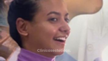 Otoplastia - Dr. Reinel Mesa