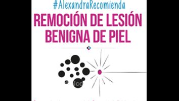 Remoción lesiones benignas