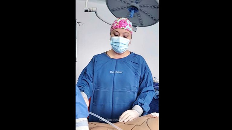 Gluteoplastia + Abdominoplastia - Dra. Natalia Reyes