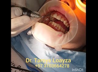 Sonrisa Perfecta Dental - Dra. Tarsys Loayza Roys