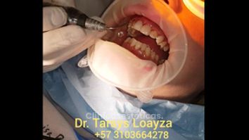 Sonrisa Perfecta Dental - Dra. Tarsys Loayza Roys