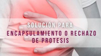 Solución para Encapsulamiento o rechazo de Protesis