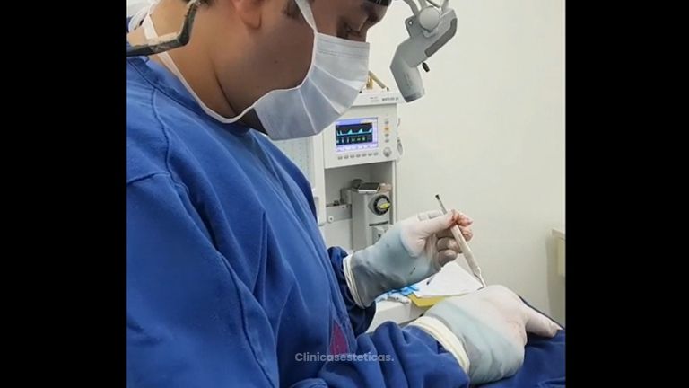 Rinoplastia