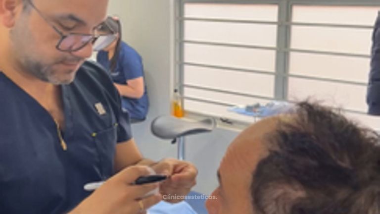 Proceso Implante Capilares - Innovart Medical IPS