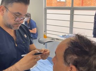 Proceso Implante Capilares - Innovart Medical IPS