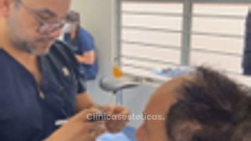 Proceso Implante Capilares - Innovart Medical IPS