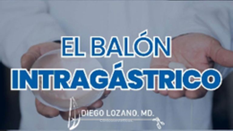 VIDEO DR LOZANO EXPLICANDO PROCEDIMIENTO DE EL BALON INTRAGASTRICO