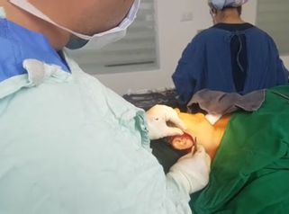Lifting facial