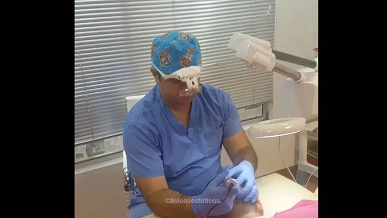 Técnica FUE