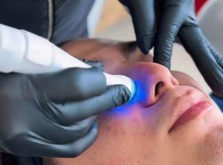 Tratamiento facial también para hombres - Dra. Carmen Padilla