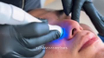 Tratamiento facial también para hombres - Dra. Carmen Padilla