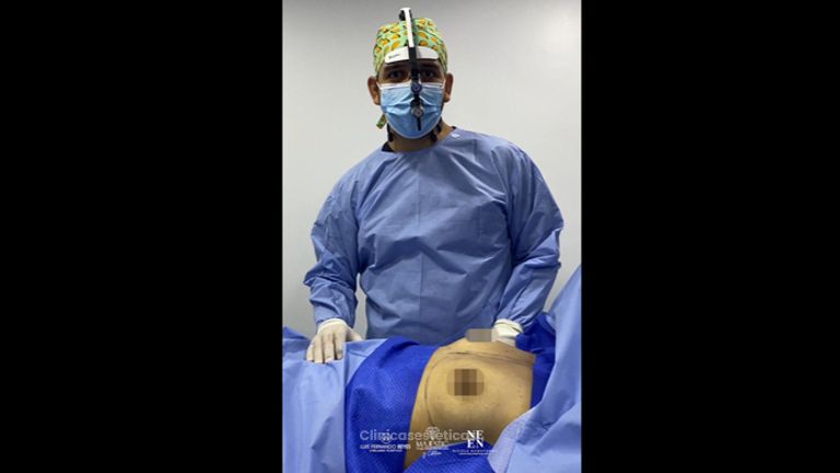 Mamoplastia de aumento - Dr. Luis Fernando Reyes & Dra. Nicole Echeverry