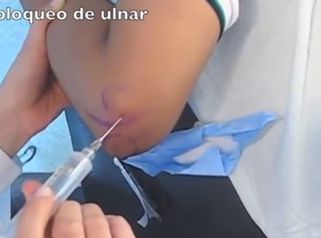 Así se realiza un bloqueo de mano