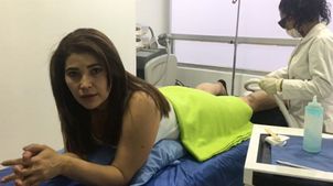 Depilación láser paciente Depilación láser paciente