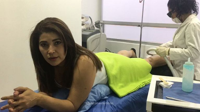 Depilación Láser  