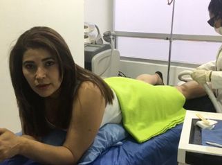Depilación Láser  