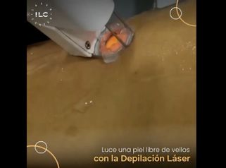 Depilación láser - Innova Laser Center