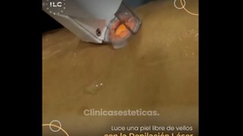 Depilación láser - Innova Laser Center