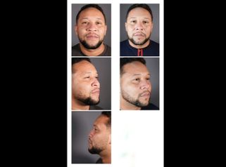 Rinoplastia - Dr Fulvio Alexander Correa
