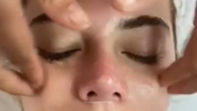 Limpieza facial profunda - Novastética