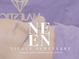 Rinoplastia - Dra. Nicole Echeverry