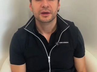 Real Hair Transplant Experience - Pilocare