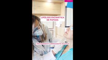 Lipólisis enzimática de papada - Doctora Alexandra Mora