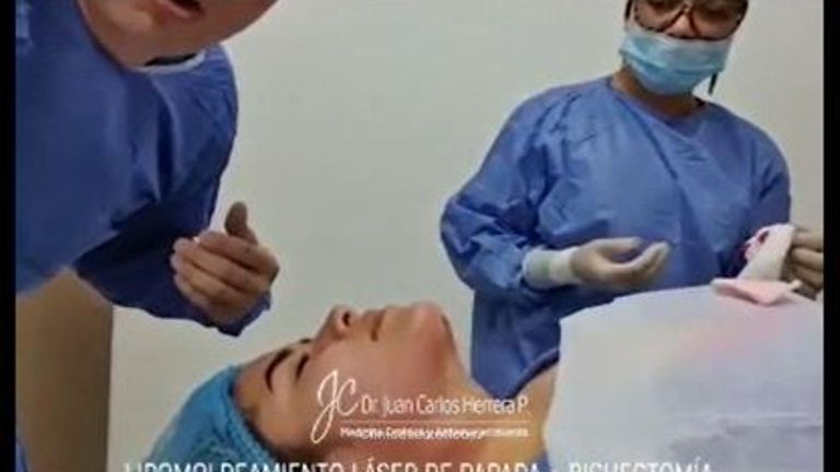 Lipo Papada