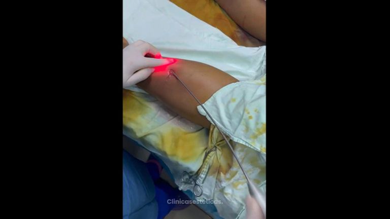 Biopolimeros - Dra. Ángeles Esmeral