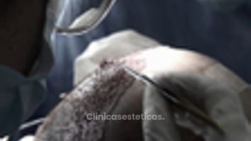 Acompañamiento médico hasta el final  - Innovart Medical IPS