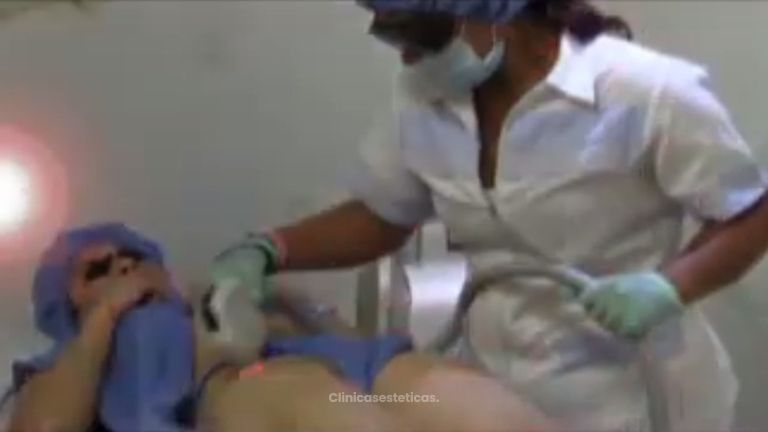 La mejor opción para acabar con el vello corporal