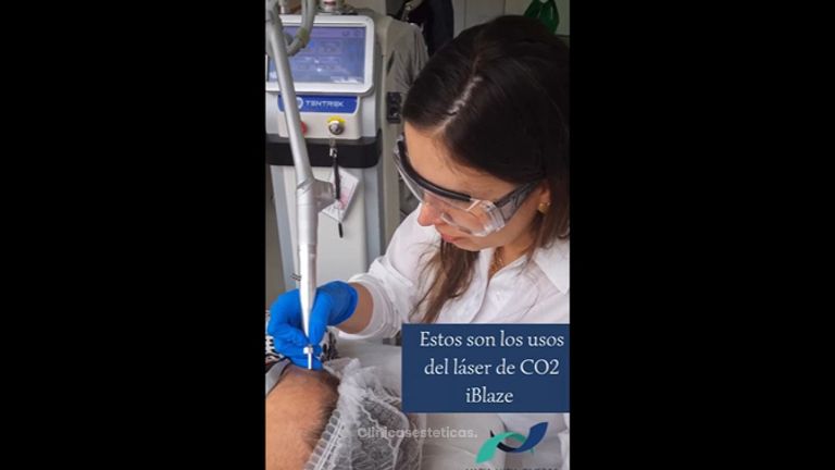 Laser CO2 - Dra. María Lucia Riveros Rueda